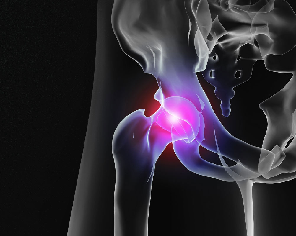 Bone Doctor Expertise in your Hip Replacement Care